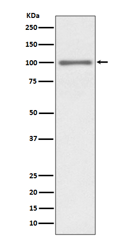 Rabbit Polyclonal Antibody to KMT6