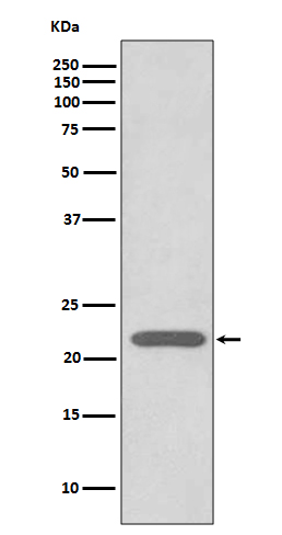 Rabbit Polyclonal Antibody to Peroxiredoxin 2