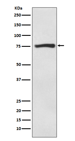 Rabbit Polyclonal Antibody to ACSS2