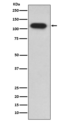 Rabbit Polyclonal Antibody to Insulin Degrading Enzyme