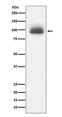 Rabbit Polyclonal Antibody to Glucocorticoid Receptor