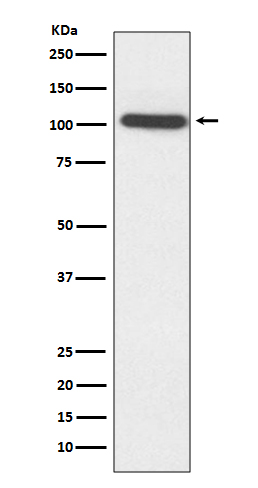 Rabbit Polyclonal Antibody to Sarcomeric alpha Actinin
