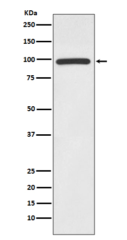 Rabbit Polyclonal Antibody to HMGCR