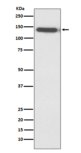 Rabbit Polyclonal Antibody to Ctip2