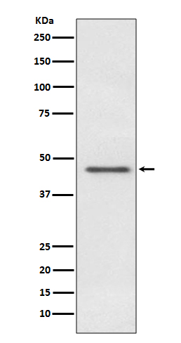 Rabbit Polyclonal Antibody to Pyruvate Dehydrogenase E1 alpha