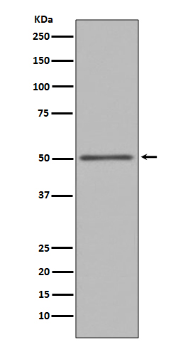 Rabbit Polyclonal Antibody to FOXA1