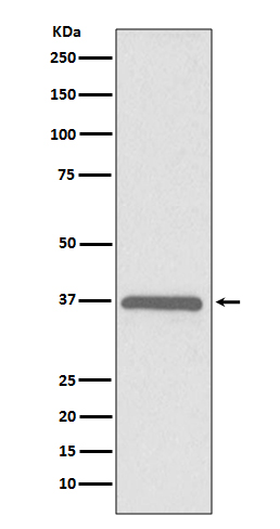 Rabbit Polyclonal Antibody to ERCC1
