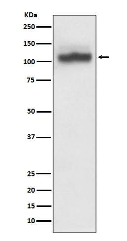 Rabbit Polyclonal Antibody to SERCA2 ATPase