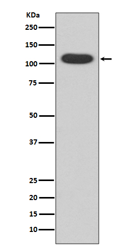 Rabbit Polyclonal Antibody to Aryl Hydrocarbon Receptor