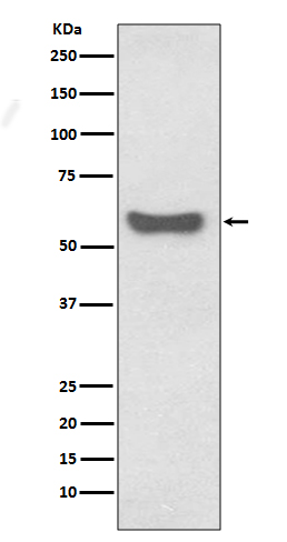 Rabbit Polyclonal Antibody to Human IgA