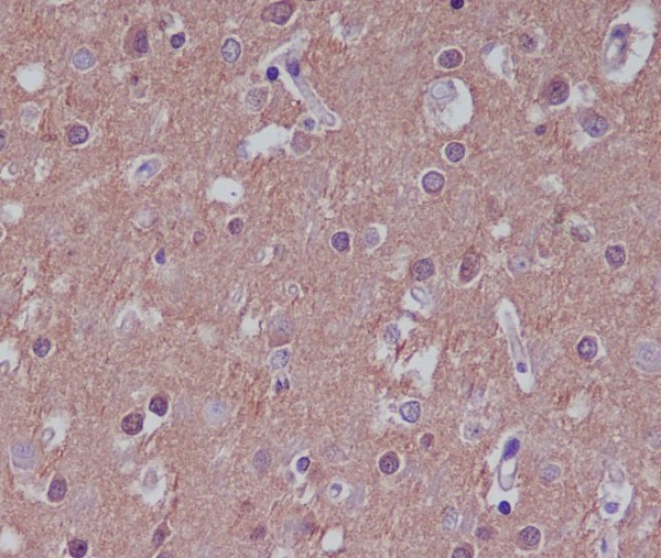 Rabbit Polyclonal Antibody to Substance P