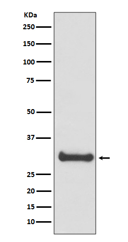 Rabbit Polyclonal Antibody to Calbindin