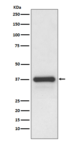 Rabbit Polyclonal Antibody to Podoplanin