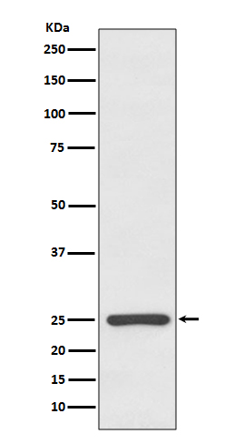 Rabbit Polyclonal Antibody to Human kappa Light Chain