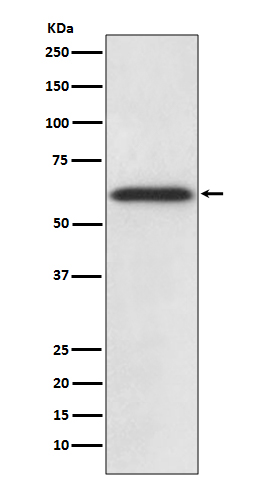 Rabbit Polyclonal Antibody to Catalase