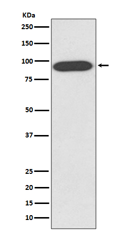 Rabbit Polyclonal Antibody to VCP