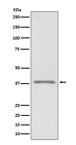 Rabbit Polyclonal Antibody to Podoplanin