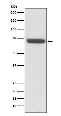 Rabbit Polyclonal Antibody to TNF Receptor 2