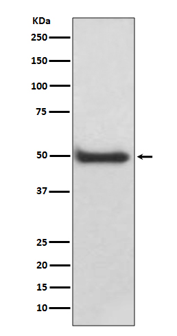 Rabbit Polyclonal Antibody to CaMKII delta