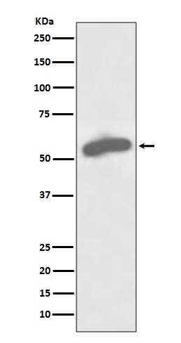 Rabbit Polyclonal Antibody to Glucose 6 Phosphate Dehydrogenase