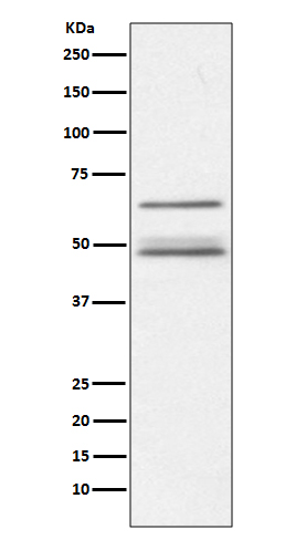 Rabbit Polyclonal Antibody to IKK gamma