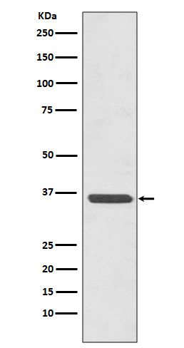 Rabbit Polyclonal Antibody to Annexin A2