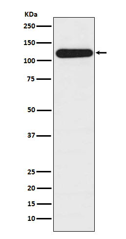 Rabbit Polyclonal Antibody to BUBR1