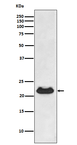 Rabbit Polyclonal Antibody to alpha B Crystallin