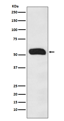 Rabbit Polyclonal Antibody to Human IgG