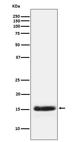 Rabbit Polyclonal Antibody to PLGF