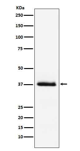 Rabbit Polyclonal Antibody to Parathyroid Hormone