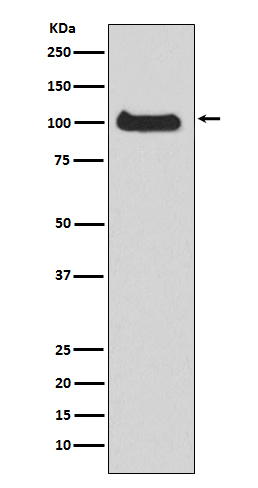 Rabbit Polyclonal Antibody to PKD1