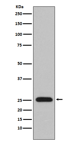 Rabbit Polyclonal Antibody to Lambda Light Chain