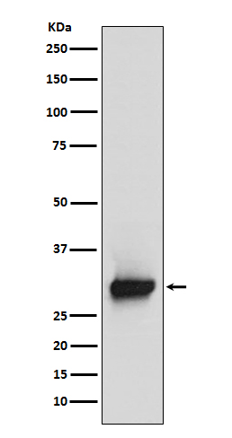 Rabbit Polyclonal Antibody to Calretinin
