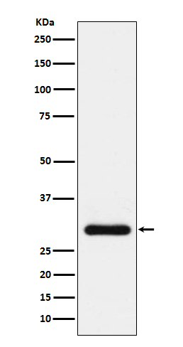 Rabbit Polyclonal Antibody to BNP