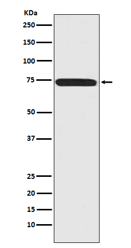 Rabbit Polyclonal Antibody to Menin