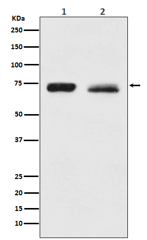 Rabbit Polyclonal Antibody to NF2