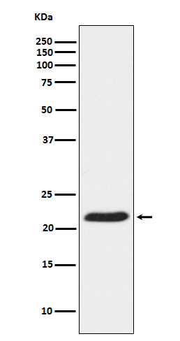 Rabbit Polyclonal Antibody to TCTP