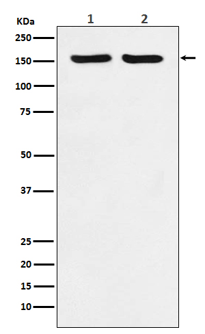 Rabbit Polyclonal Antibody to ROCK2