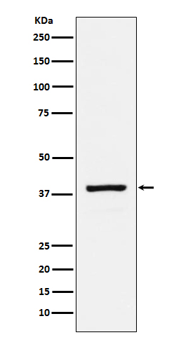 Rabbit Polyclonal Antibody to RASSF1