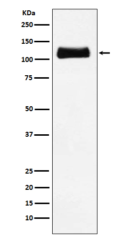 Rabbit Polyclonal Antibody to ApoER2