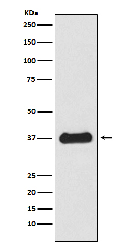 Rabbit Polyclonal Antibody to Follistatin