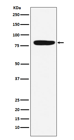 Rabbit Polyclonal Antibody to Factor XIIIa