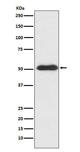 Rabbit Polyclonal Antibody to Slit2