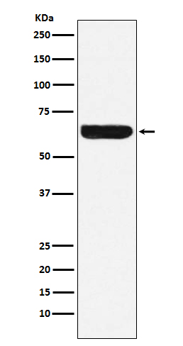Rabbit Polyclonal Antibody to Placental Alkaline Phosphatase