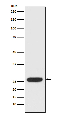 Rabbit Polyclonal Antibody to StAR