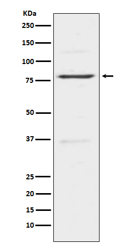 Rabbit Polyclonal Antibody to Insulin Receptor Related Protein