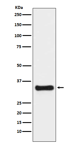 Rabbit Polyclonal Antibody to Thymidylate Synthase