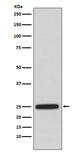 Rabbit Polyclonal Antibody to HPRT
