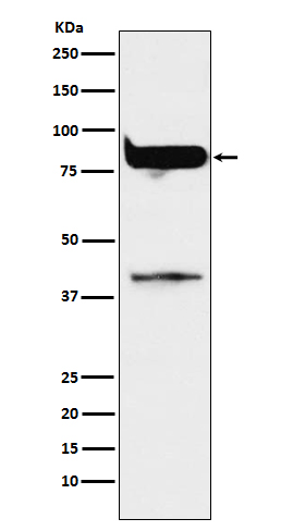 Rabbit Polyclonal Antibody to PKC eta